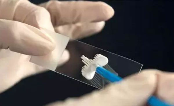 tct检查后可能会出现哪些症状？tct检查后症状一览