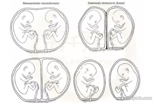 双绒双羊能判断为龙凤胎吗？龙凤胎的生理特征
