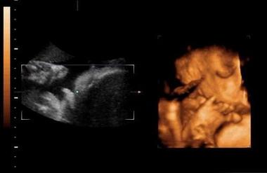 四维单上出现这四个字是怀了男宝，85%都已证实！