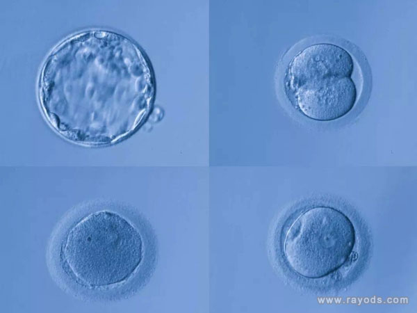 高龄试管养囊有什么好处,高龄试管是否应该养囊