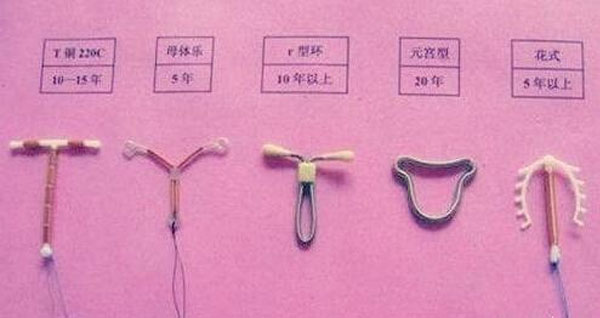 避孕环种类哪种好_避孕环有有效期吗_上避孕环的注意事项
