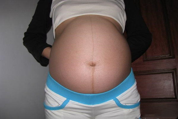 肚子上长毛是男孩女孩 孕妇肚子长毛可以看男女吗