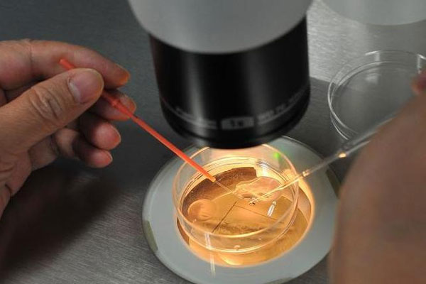 紧急！求做了试管的姐妹告知到底是取卵痛还是宫腔镜痛