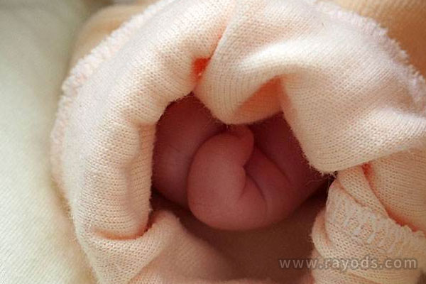 宝宝是母乳性黄疸妈妈不可以吃什么？喂养要注意什么？