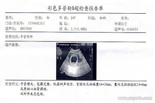 怀孕B超单图片你真的会看吗？怀孕B超全解析