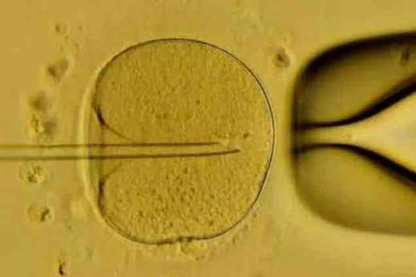 47岁的女性能不能做试管呢？成功率是多少？