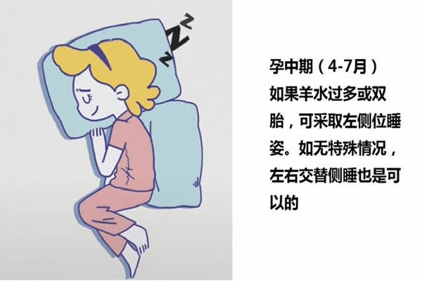 孕中期可以平躺睡觉吗？产科医生建议最好采用左侧卧
