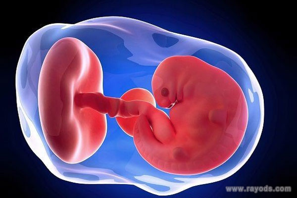 孕期出现空孕囊的原因以下4点因素有关