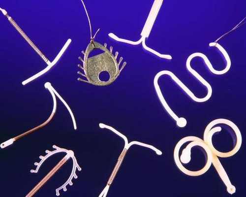 避孕环要多少钱_什么是避孕环_避孕环的种类哪种好