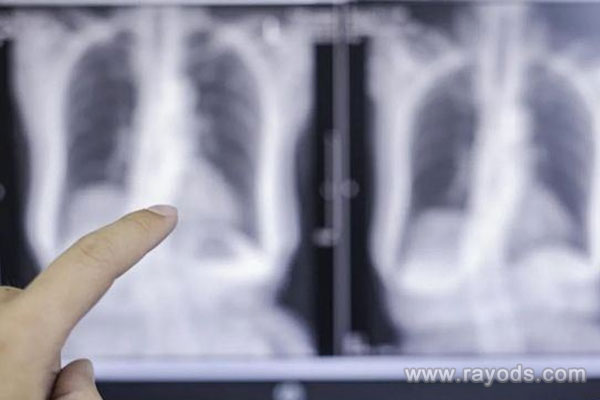 多次胸透检查之后对胎儿的影响是很大吗？