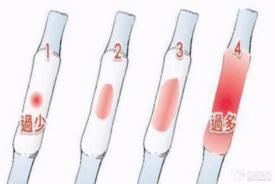 月经来得不正常会导致不孕不育吗？万事皆可能，当心为上