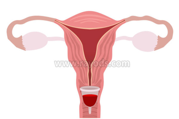 促排卵效果不理想，俄罗斯试管婴儿还需要继续吗？