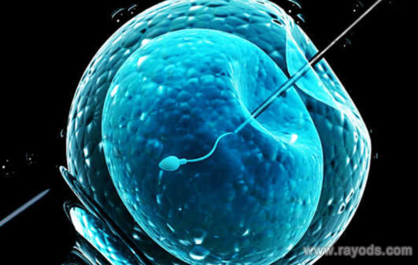 女性免疫性不孕去俄罗斯MD医疗集团做试管有用么？