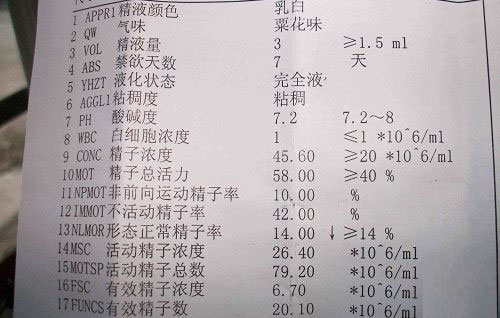 精液常规检查费用多少,精液常规检查参考值