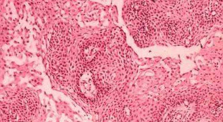 催乳激素是什么_偏高偏低|正常值|作用及治疗方法