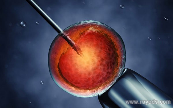 卵巢早衰到俄罗斯做供卵试管婴儿要带多少钱?