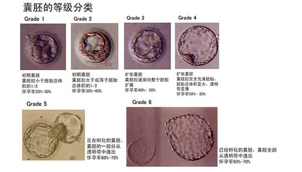 北医三院养囊成功率高吗？胚胎质量才是关键因素