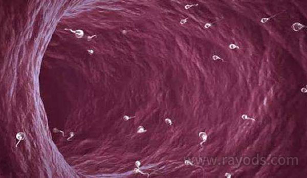 继发性不孕会出现精卵结合障碍吗？怎么治疗？