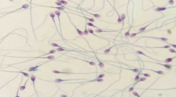 畸形精子类别多，简述不同形态的精子对怀孕的影响