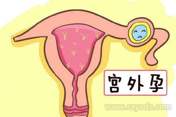 同是宫外孕为什么处理方式不一样？这一点很关键