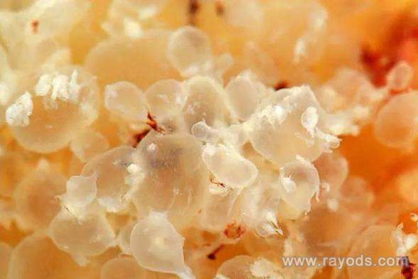 什么体质的女人容易怀葡萄胎？