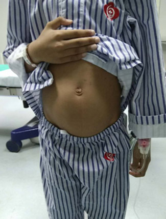 9岁小女孩也得卵巢肿瘤？小女孩还需警惕这些妇科病！