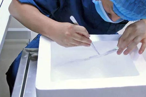 做试管婴儿什么情况下才有机会养囊？风险怎么样？