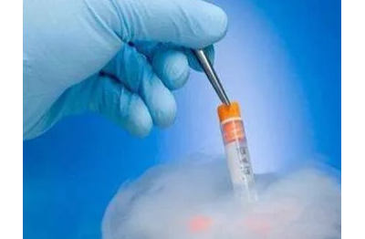 为何林志玲、徐静蕾都去选择冷冻卵子？关于冻卵你了解多少？