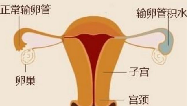独家揭秘：人工授精过程中不为人知的细节