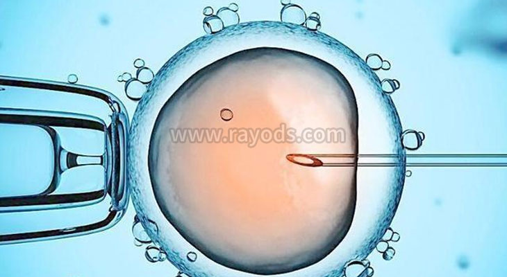网友问答：日本试管婴儿费用大概是怎么计算的？