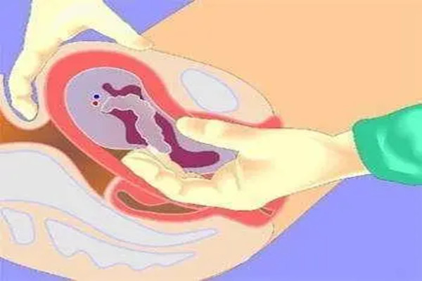 人工受孕痛吗？人工授精采用无创和微创技术一般不疼