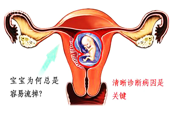专家解析习惯性流产最常见的5个原因，早知道才能早避免