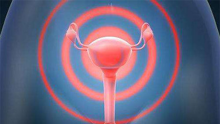 什么是子宫内膜炎，子宫内膜炎