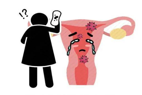 宫颈癌发出的第一个信号通常是接触性出血 千万得重视