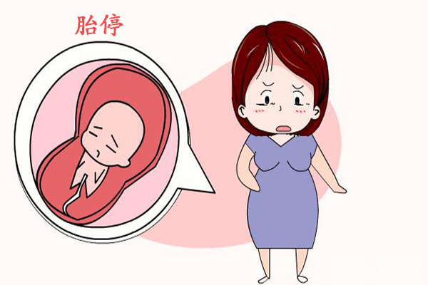 怎样自测是否胎停-怀孕胎停的五个症状，准妈妈快来自测一下吧！