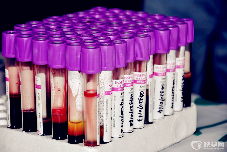 amh与年龄对照表-专家解读不同年龄amh参考值