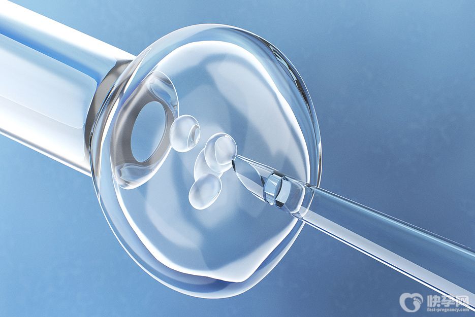 先天性无输精管只能做试管吗？看完你就知道了