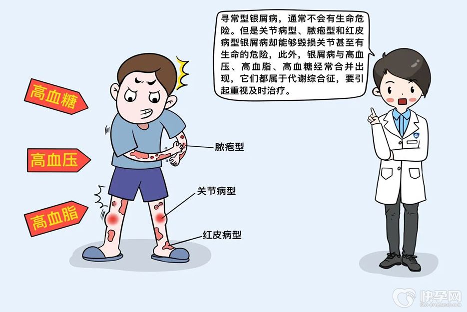 试管婴儿能避免遗银屑病吗？选择第三代试管技术就能有效避免