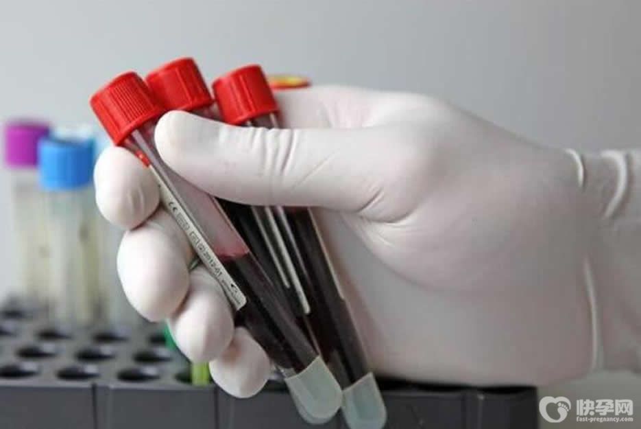 fsh18能自然怀孕吗？有一定可能性但不可轻视