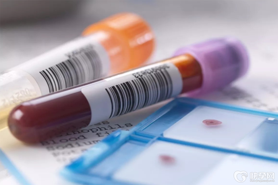 FSH值30多还可以做试管婴儿吗？不放弃就有成功的可能