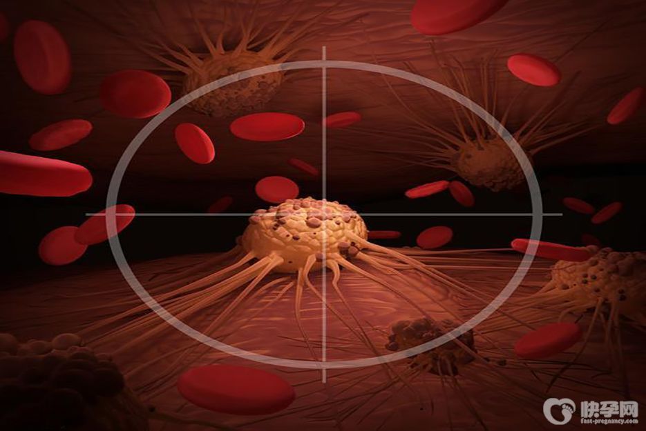 肺部原位癌手术后还能做试管婴儿怀孕吗?不一定-需要具体情况具体分析