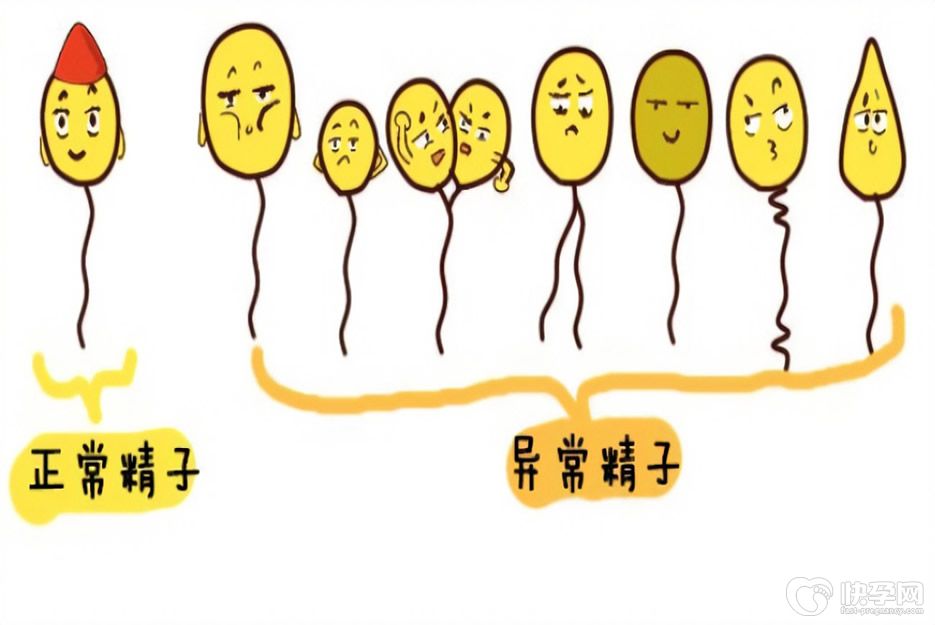 精子畸形率100%可以做试管婴儿吗？希望就在一线之间