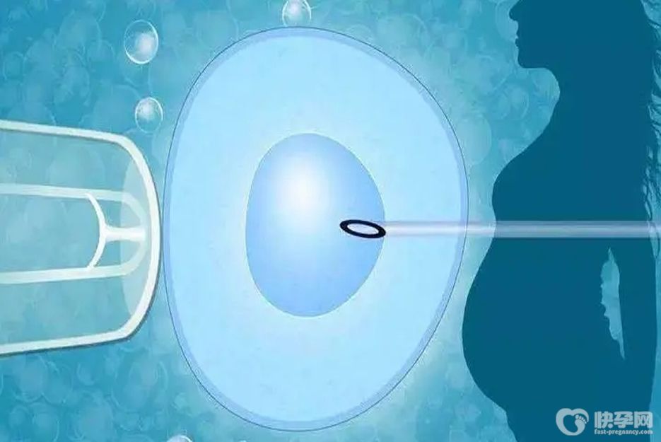 怀不了孕可以做试管婴儿吗？且看是否有这7种适应症的其中之一