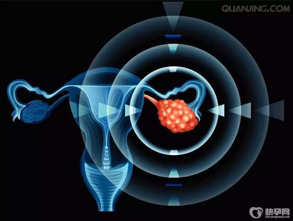 无卵可以做试管婴儿吗-相信奇迹会发生