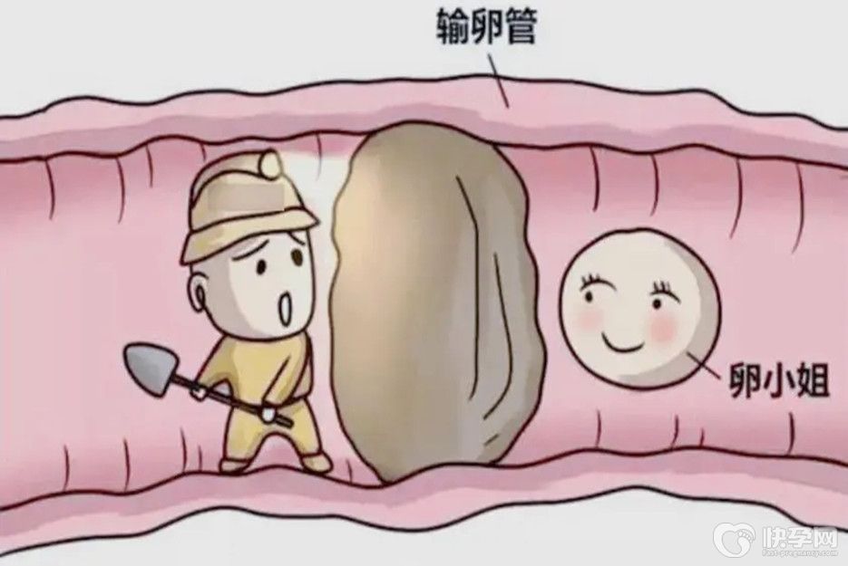 输卵管堵塞的症状，输卵管堵塞的原因-一文道出输卵管堵塞的“机密”