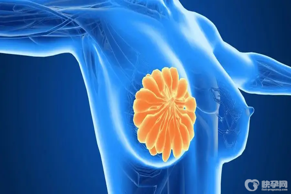 乳腺癌是怎么引起的，五大预防措施破防乳腺癌的发生