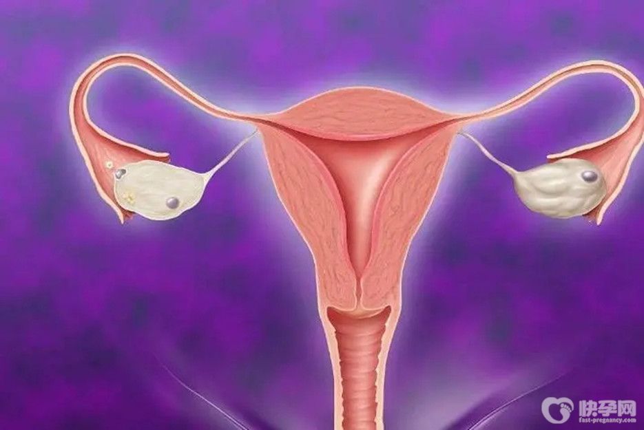 六点带你了解幼稚子宫和始基子宫的区别-别在混为一谈了