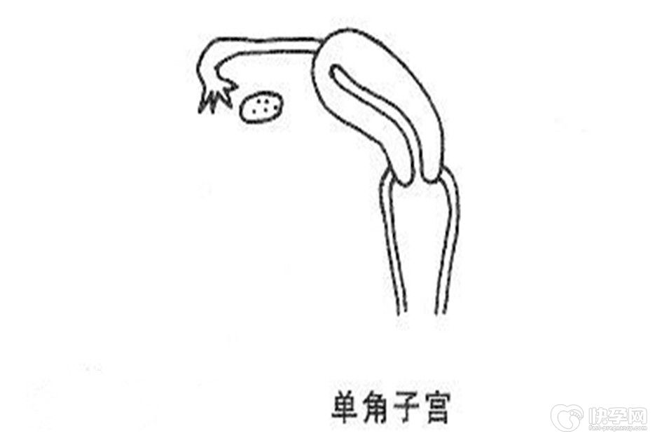 单角子宫怀孕后期不能吃什么，这六种食物是大忌