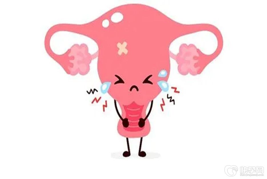 热门话题：宫舒贴可以治子宫腺肌症吗？专家带你了解真相