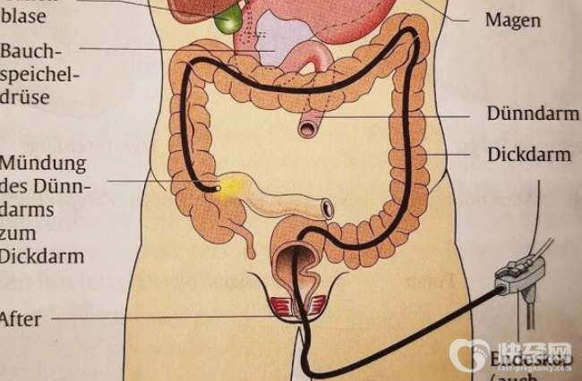 大便不成形的原因有哪些，一般是这4个因素惹的祸